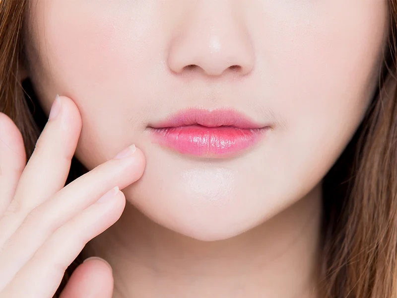 Cheek Fillers Ashford Kent