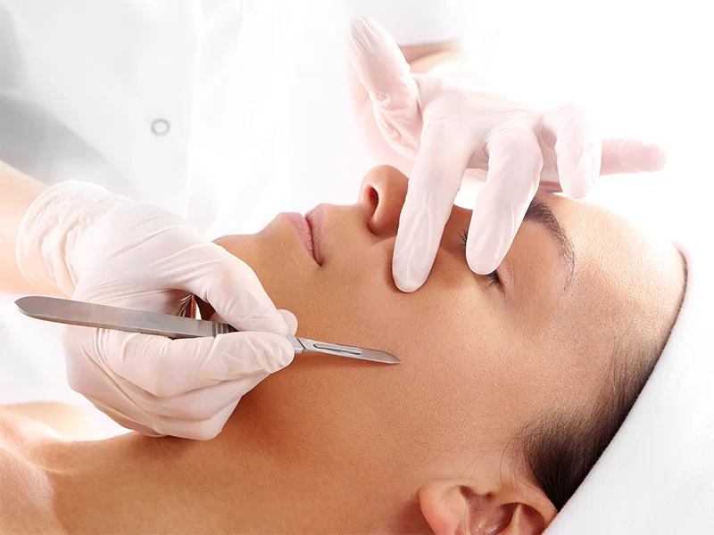 Dermaplaning Ashford Kent