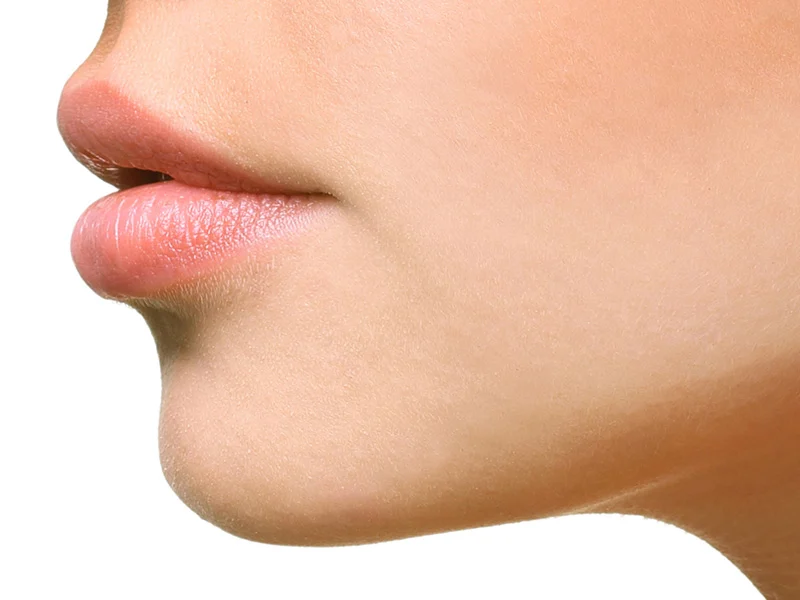 Jawline Fillers Ashford Kent