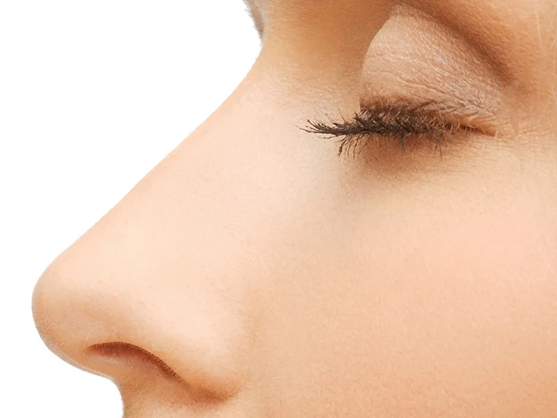 Rhinoplasty Ashford Kent